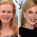Nicole Kidman: Libera dal botox e più bella, un anno dopo a Cannes